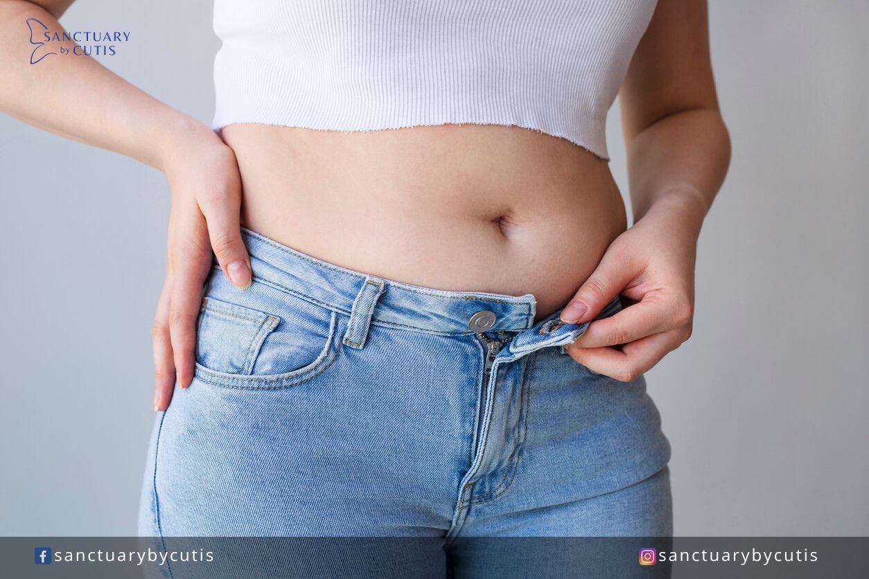 Belly Bulge: Is it Bloating or Belly Fat?