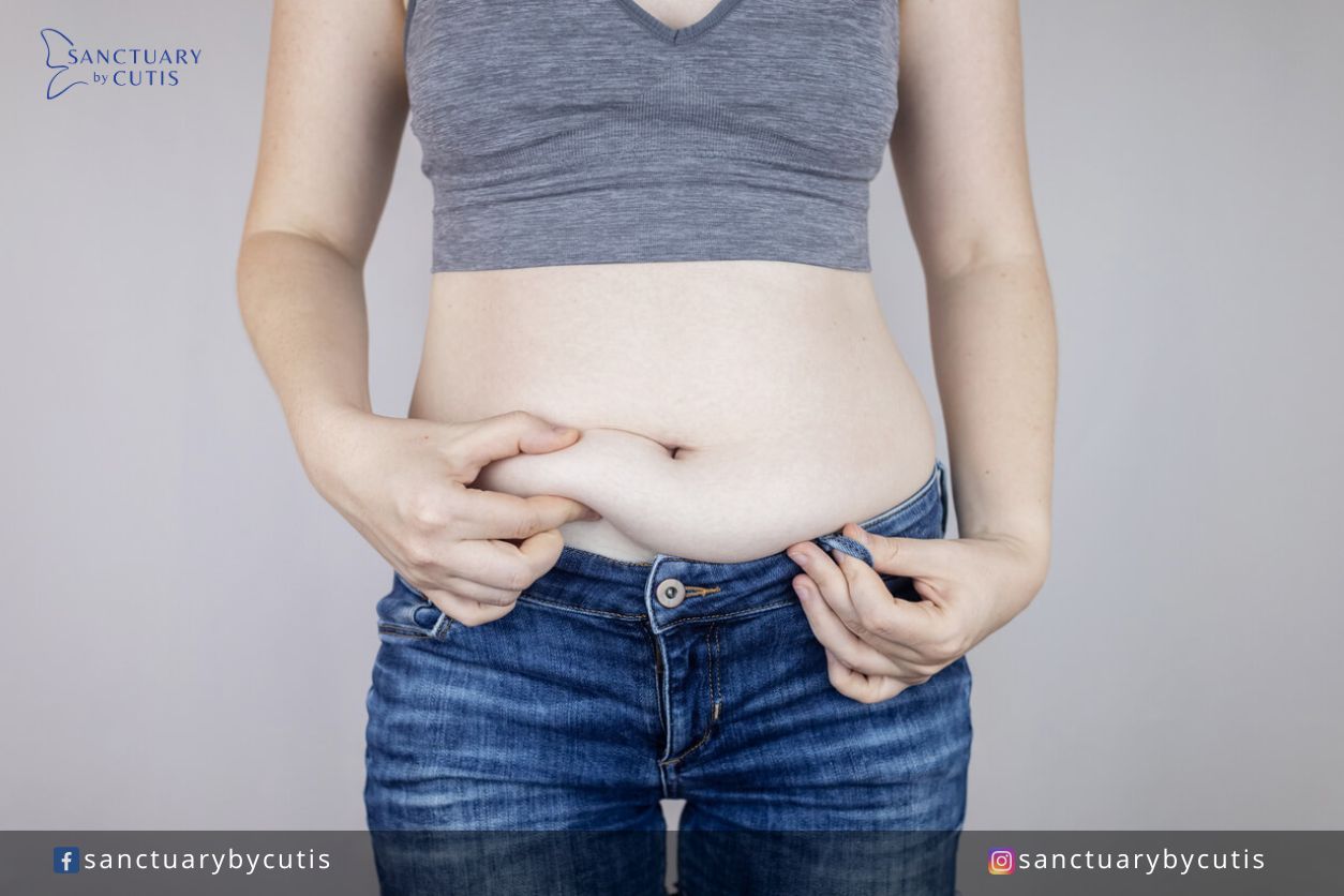 Who are good candidates for non-invasive body contouring