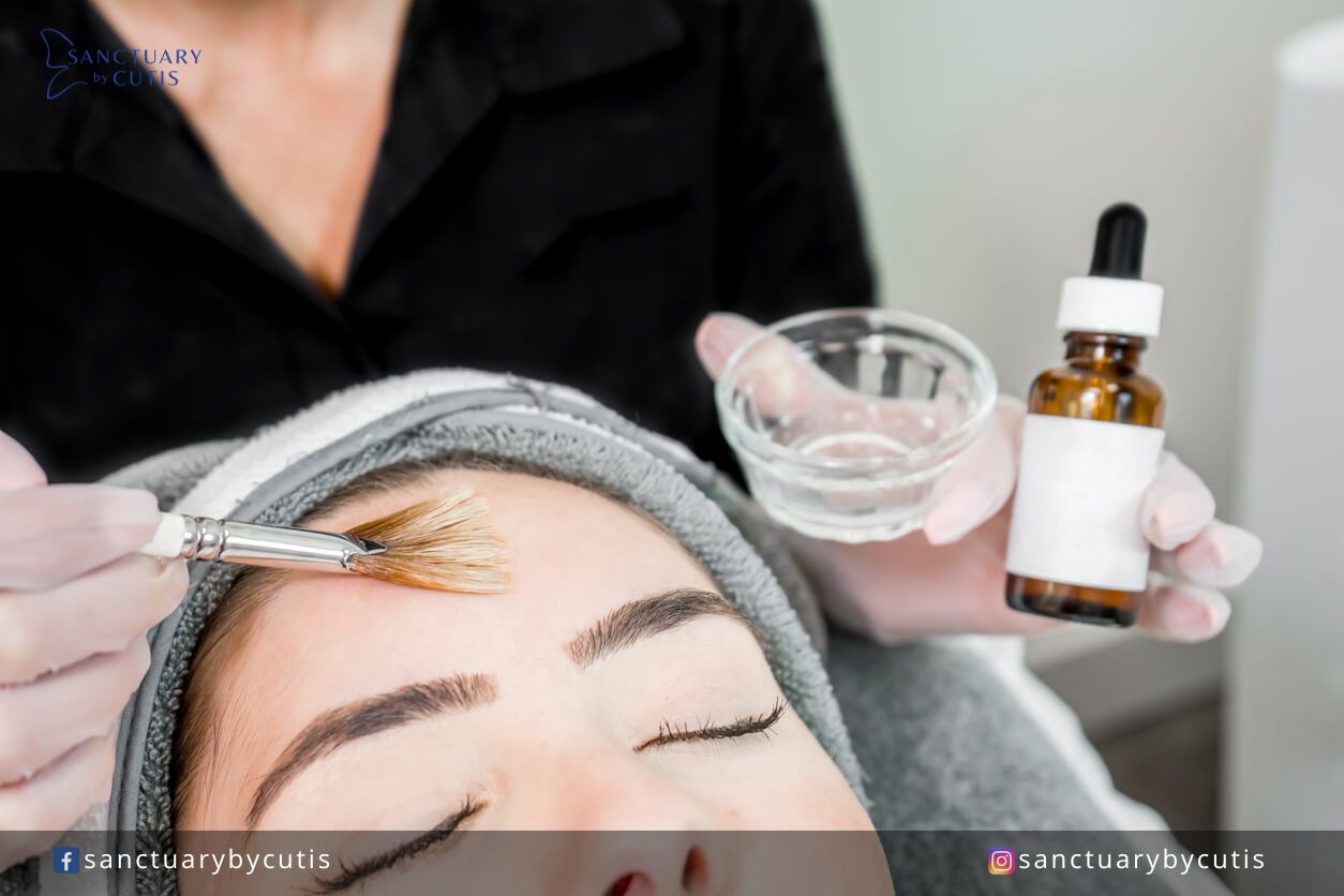 chemical peel is a skin resurfacing treatment